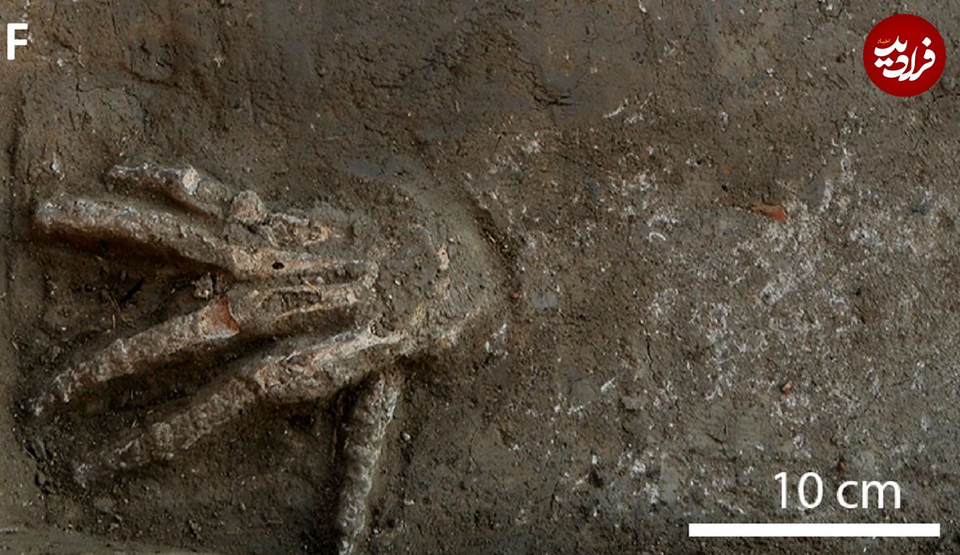 راز دست‌هایی که ۳۵۰۰ سال پیش قطع شدند