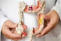 غربالگری اولیه سرطان روده بزرگ جان هزاران نفر را نجات می‌دهد