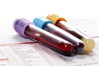 تشخیص مشکلات سیستم ایمنی با آزمایش Neutrophils