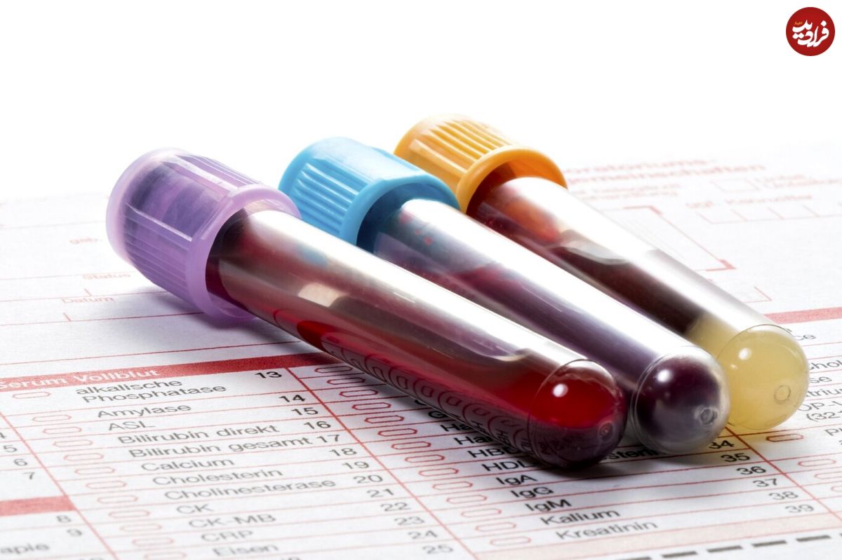 تشخیص مشکلات سیستم ایمنی با آزمایش Neutrophils