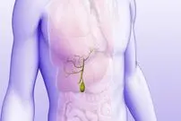 علائمی که می‌گویند کیسه صفرای شما مشکل دارد