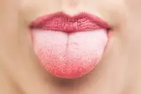 وضعیت زبان مان درباره سلامتی ما چه می‌گوید؟