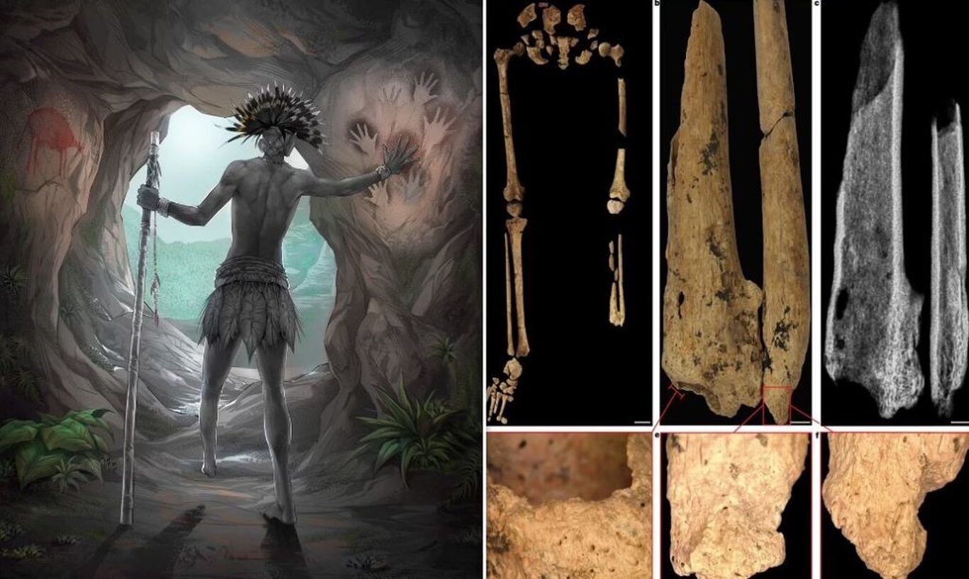 اولین و عجیب‌ترین جراحی تاریخ، ۳۱ هزار سال پیش در غار