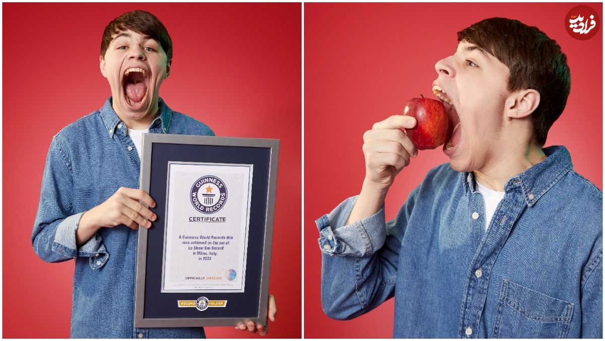 (تصاویر) نوجوانی که رکورد بزرگترین دهان جهان را شکست