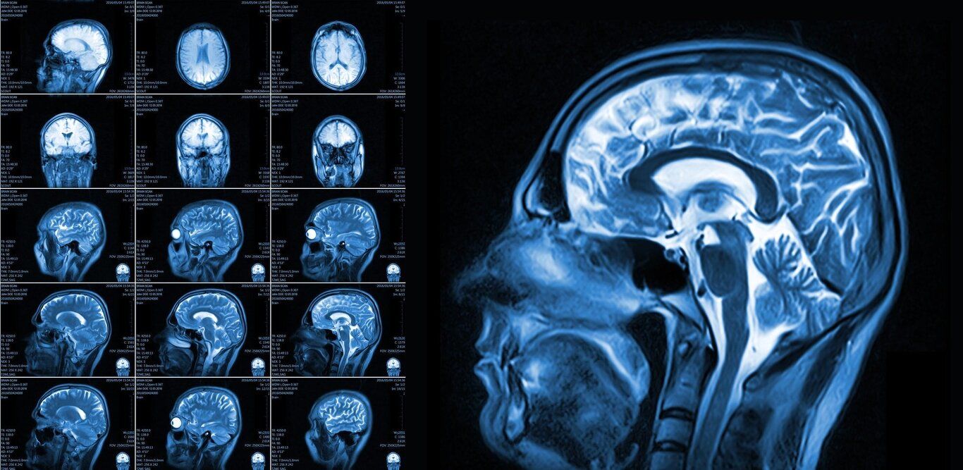 (تصاویر) ثبت واضح‌ترین اسکن‌های مغزی توسط محققان