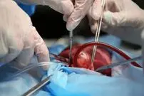 (ویدئو) نحوه انتقال استرس‌آور قلب اهدایی!