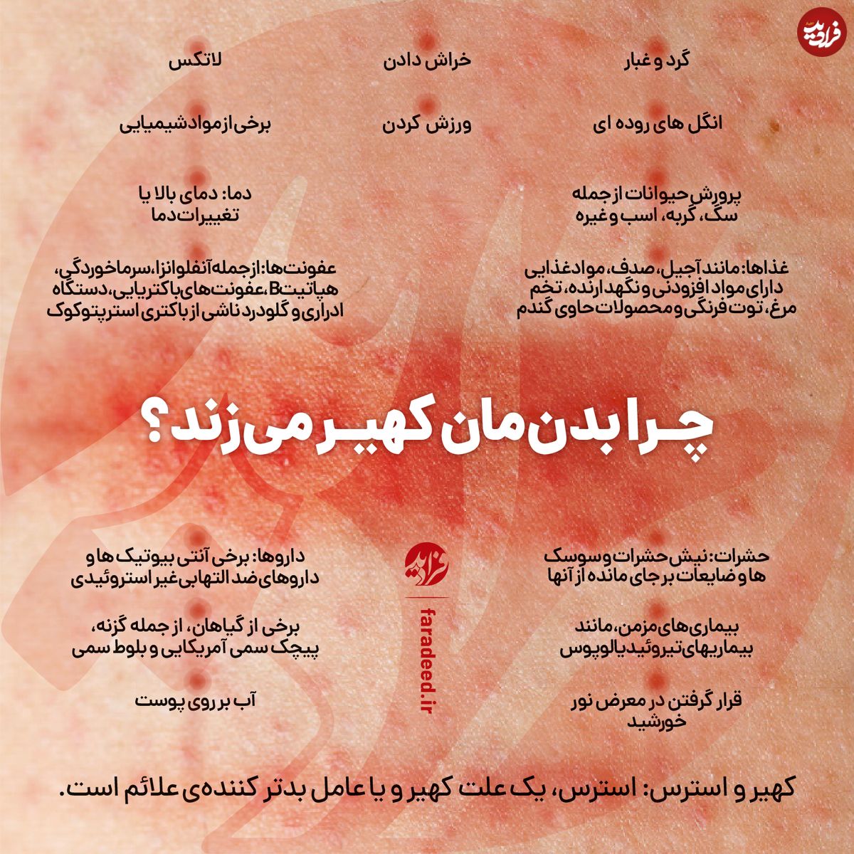اینفوگرافی/ چرا بدنمان کهیر میزند؟