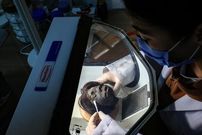 (تصاویر) داستان تکان دهنده سرهای پرتقالی با لبان دوخته شده