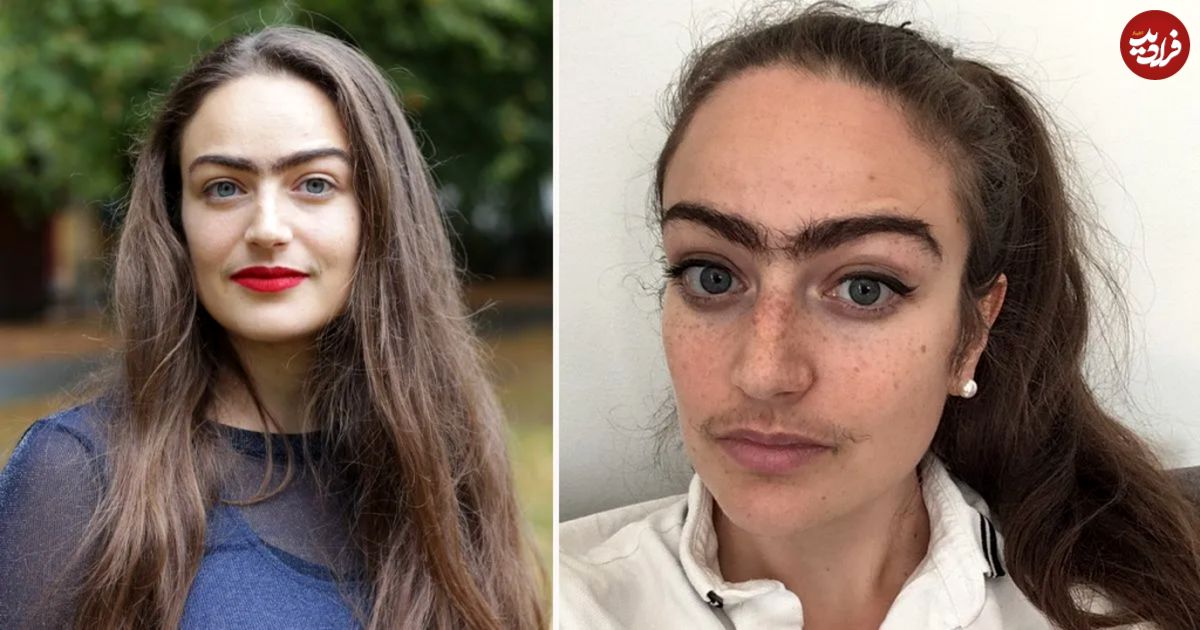 این زن با اصلاح نکردن موهای صورتش از قرار با افراد نامناسب جلوگیری می کند