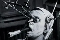 عکس| خدمات لایه برداری پوست سال 1937