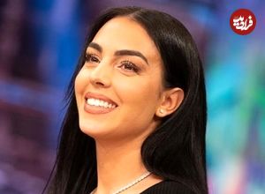 عکس؛ جورجینا قبل و بعد از عمل