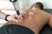 درمان میگرن با حجامت