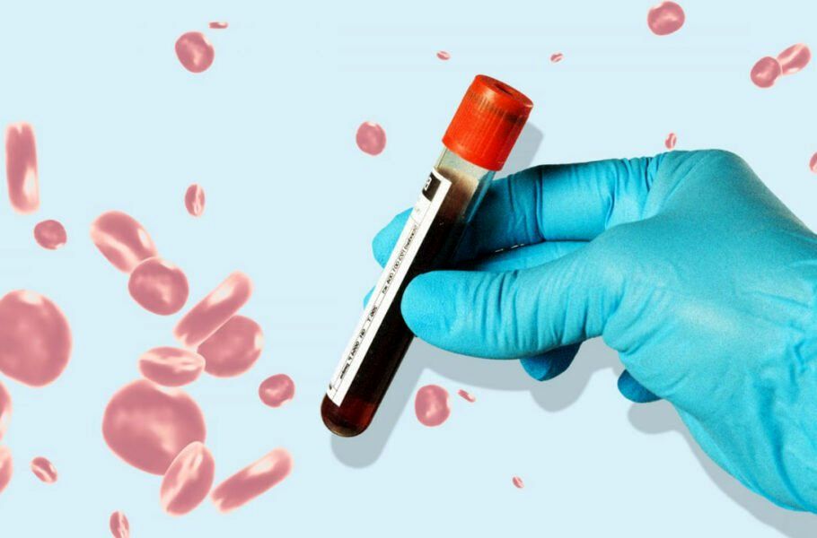  تشخیص سریع ۵۰ نوع سرطان با یک آزمایش خون ساده
