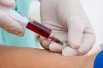 تشخیص سرطان سینه با آزمایش خون؟!