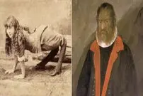 سرگذشت حقیقی ۹ انسان عجیب الخلقه که شما را شگفت زده خواهد کرد