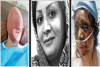 تنهایی یک زن در زندگی اسیدی