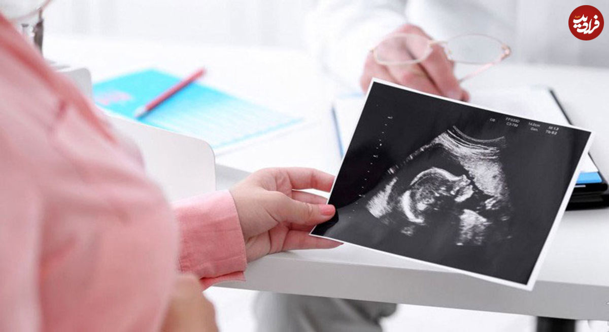 ۴ سونوگرافی ضروری برای مادران باردار