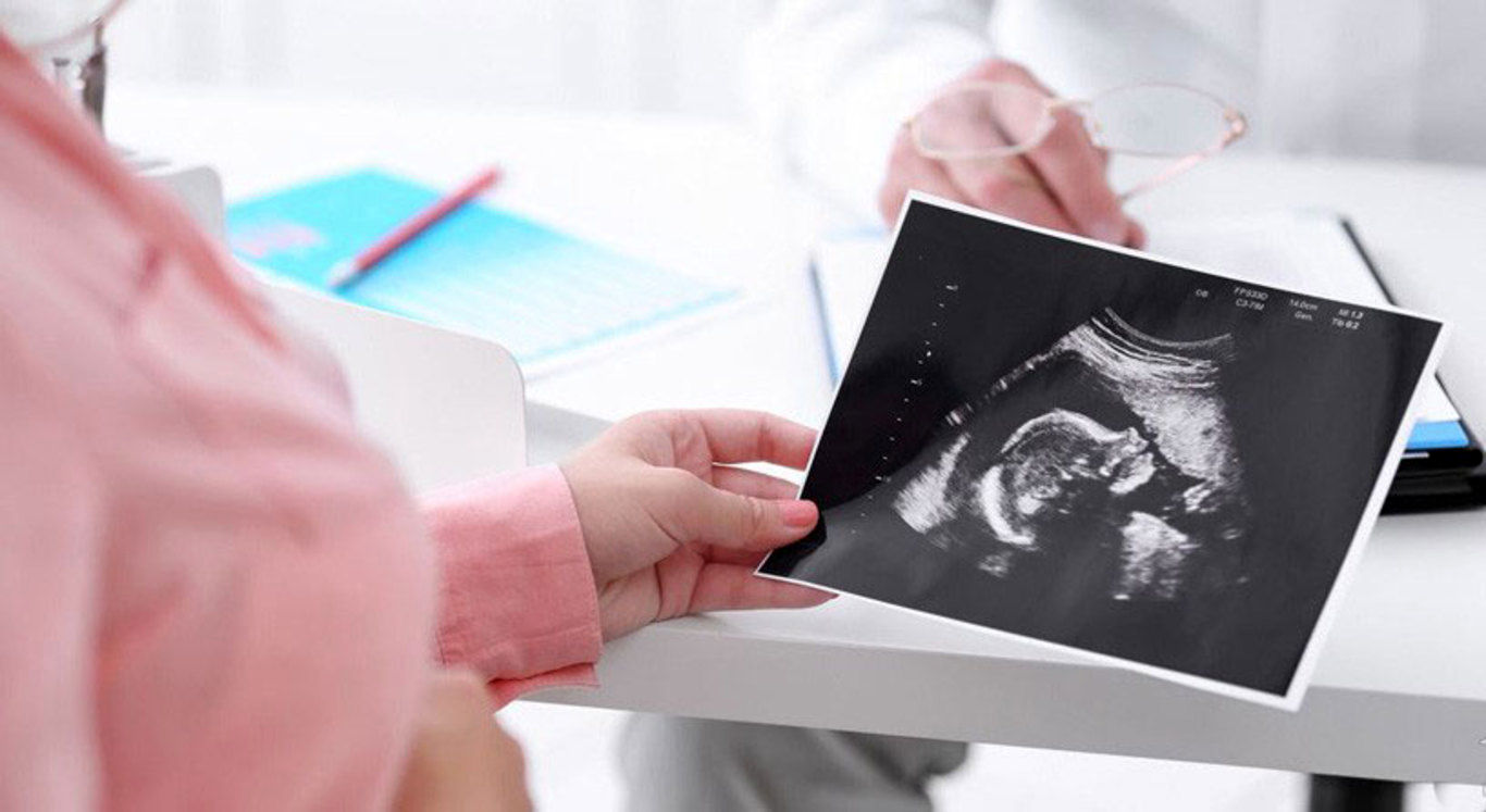 ۴ سونوگرافی ضروری برای مادران باردار