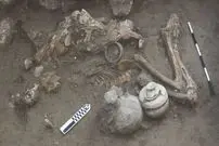 جراحی مغز در ۳۵۰۰ سال قبل؛ «بیمار چند روز پس از عمل جراحی درگذشته است»