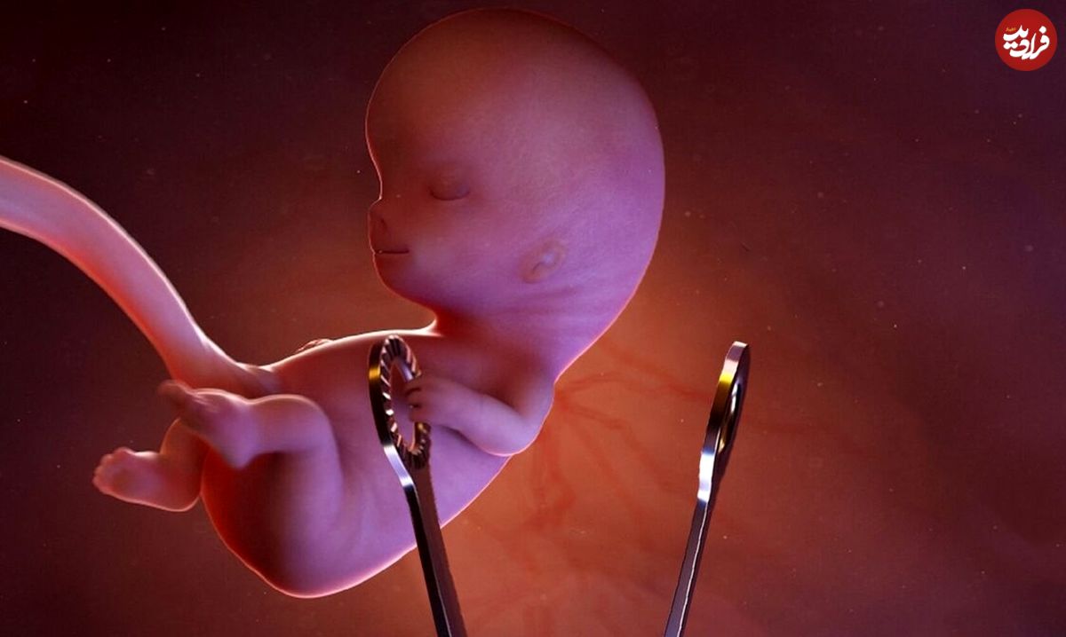 اینفوگرافیک/ ۱۰ خطر مرگبار سقط جنین