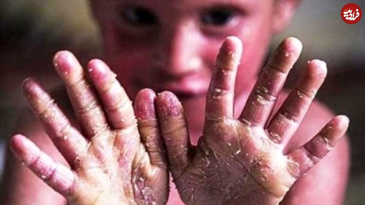 آوای دو ساله و کودکان «ایبی» پرپر میشوند