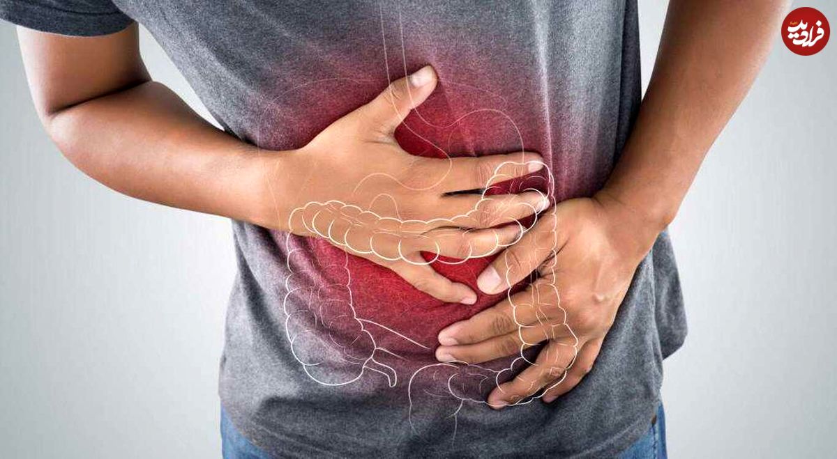 انسداد روده چیست؟ از علایم تا تشخیص و درمان