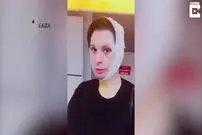 ویدیو/ جراحی پلاستیک 80 هزار دلاری!