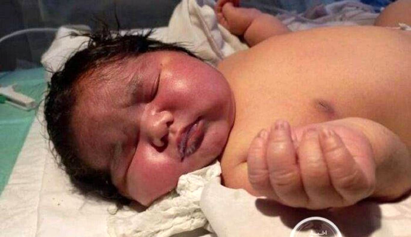 نوزاد مشهدی، سنگین وزن‌ترین نوزاد جهان است؟
