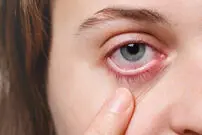 آسم، یکی از دلایل خشکی چشم!