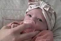 (عکس) تولد نوزاد دختر بعد از ۱۳۸ سال