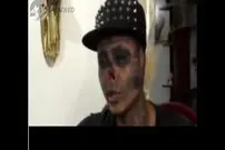 ویدیو/ پسری که برای ترسناک شدن عمل جراحی کرد!