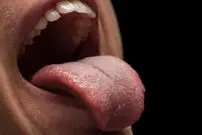 اگر این نشانه را روی زبان خود دیدید، نگران شوید!