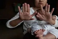 تصاویر/ نوزاد 31 انگشتی چینی