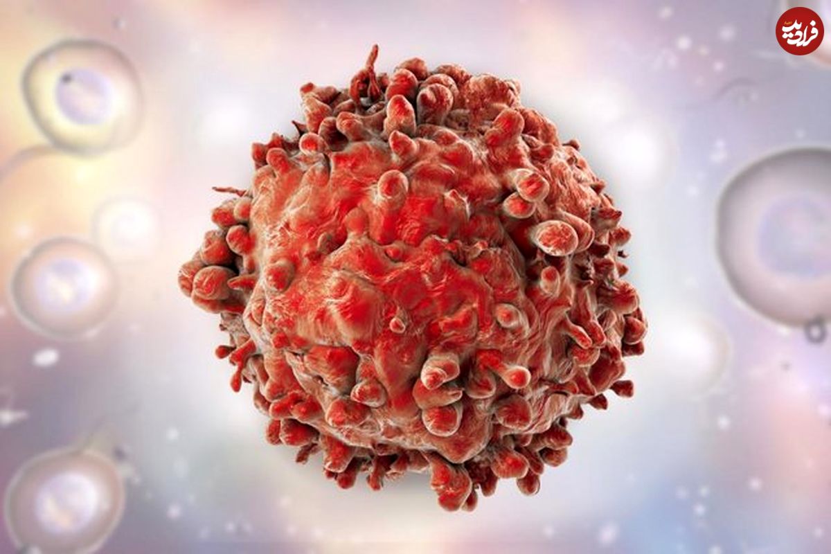 درمان بدون عارضه سرطان لوزالمعده با نانوحامل‌های پروتئینی