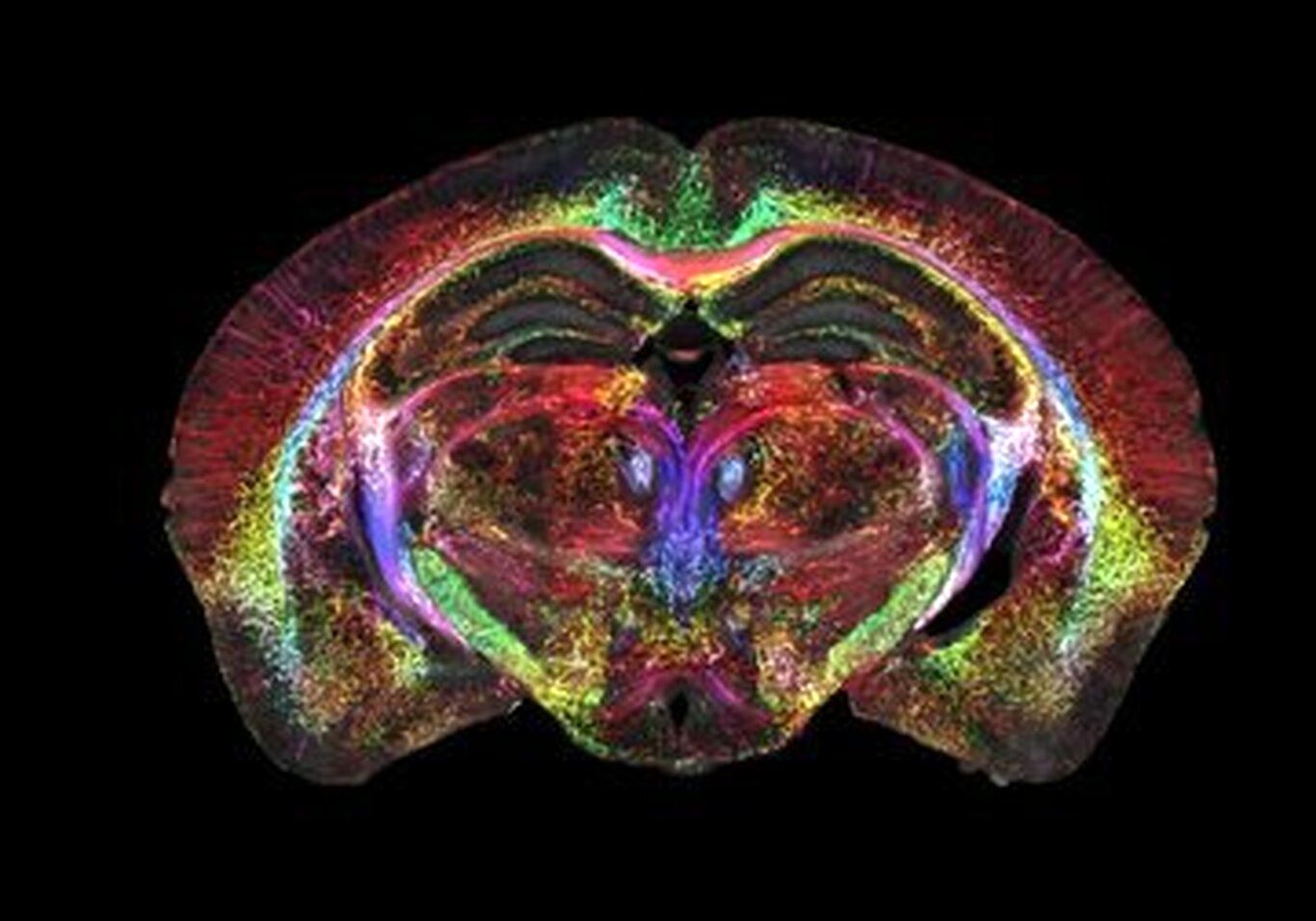 (عکس) ثبت واضح‌ترین عکسی که از مغز دیده‌اید