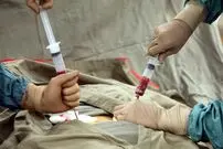 نجات مرد آلمانی از سرطان و HIV با پیوند مغز استخوان