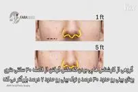 ویدیو/ چطور سلفی باعث می‌شود جراحی زیبایی بینی کنید؟!