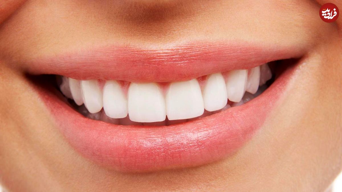درباره ایمپلنت دندان بیش‌تر بدانید