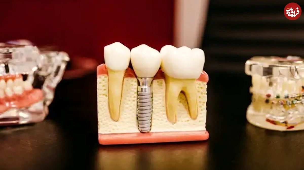 چند نکته مهم درمورد دندان درد که از آن بی‌خبرید!