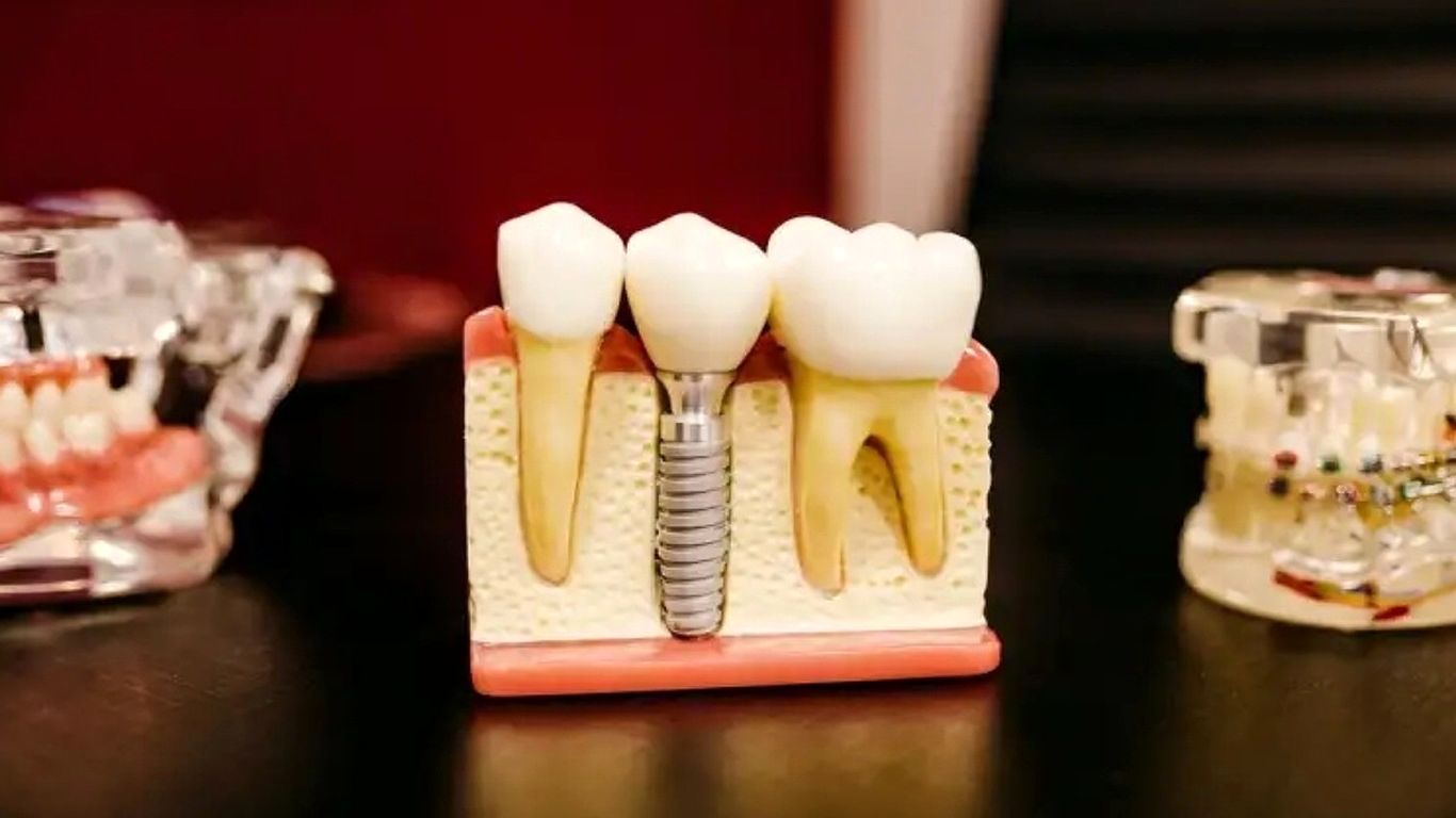 چند نکته مهم درمورد دندان درد که از آن بی‌خبرید!