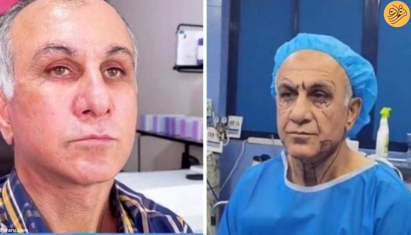 (ویدئو) پیرمردی که با انجام جراحی زیبایی جوان شد!