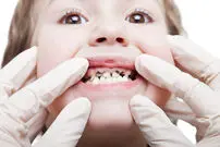 ٢٠٠ میلیون دندان خراب!