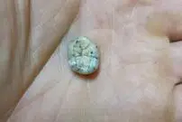 (ویدیو) کشف دندان 164 هزار ساله که اطلاعات جدیدی درباره گونه منقرض شده انسان ارائه می‌کند