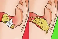 چند راهکار ساده و موثر برای حفظ تمیزی گوش ها