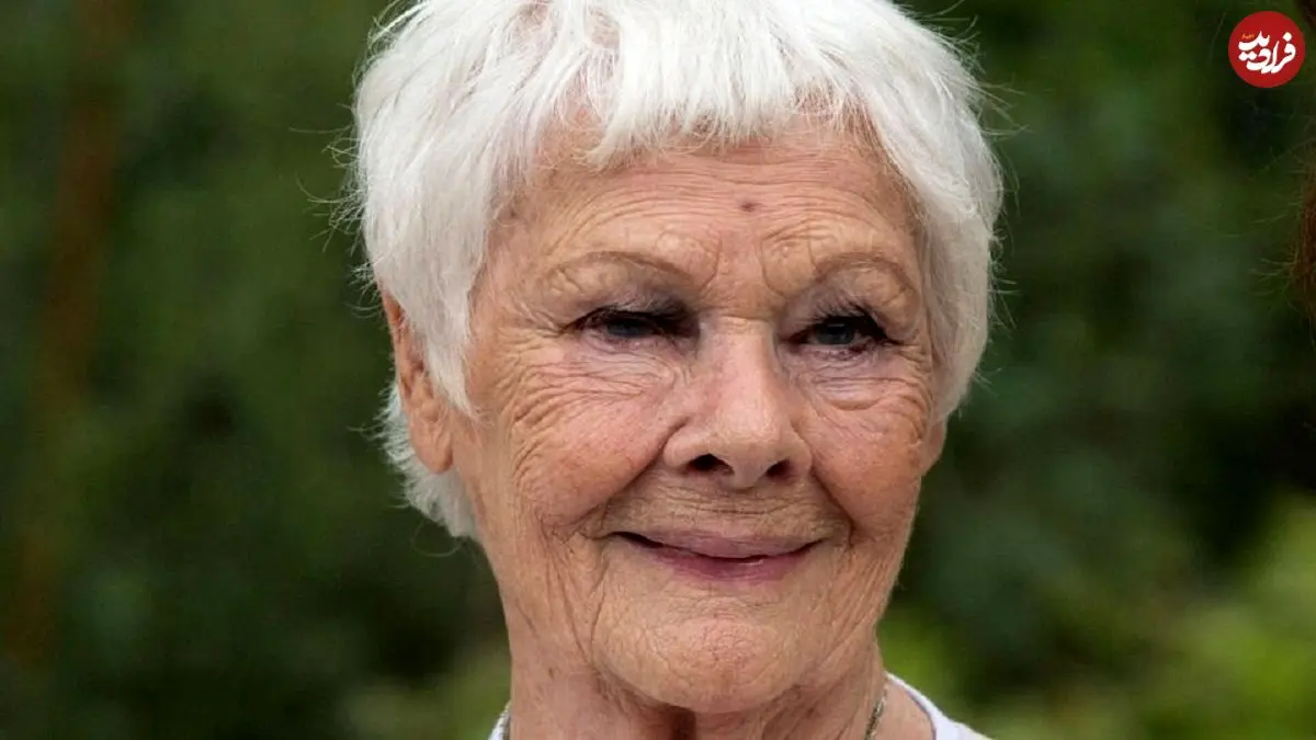 بازیگر مشهور انگلیسی دیگر نمی‌تواند ببیند و کسی را تشخیص دهد