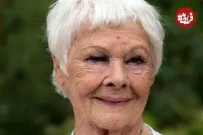 بازیگر مشهور انگلیسی دیگر نمی‌تواند ببیند و کسی را تشخیص دهد