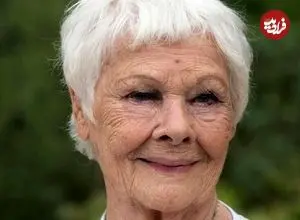 بازیگر مشهور انگلیسی دیگر نمی‌تواند ببیند و کسی را تشخیص دهد