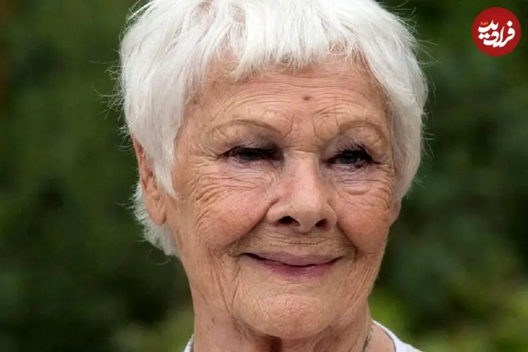 بازیگر مشهور انگلیسی دیگر نمی‌تواند ببیند و کسی را تشخیص دهد