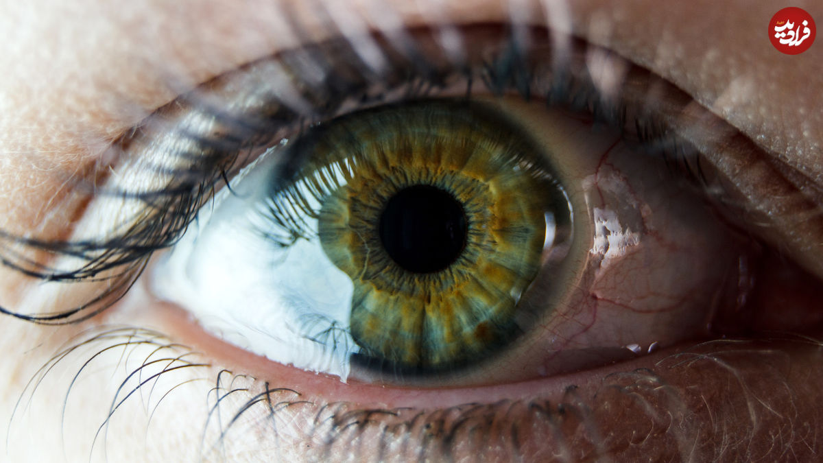 کمیاب‌ترین «رنگ چشم» جهان چه رنگی است؟ 

