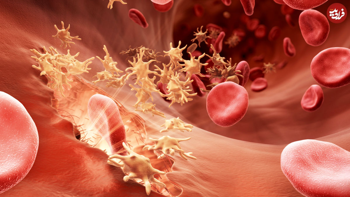 پلاکت خون بالا؛ علت، علائم و روش‌های درمان